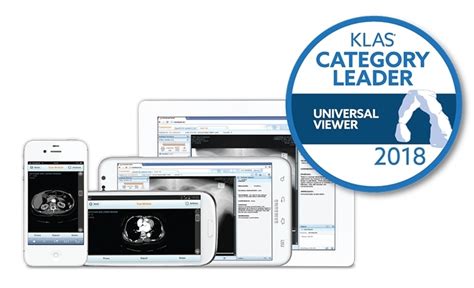 carestream universal viewer.